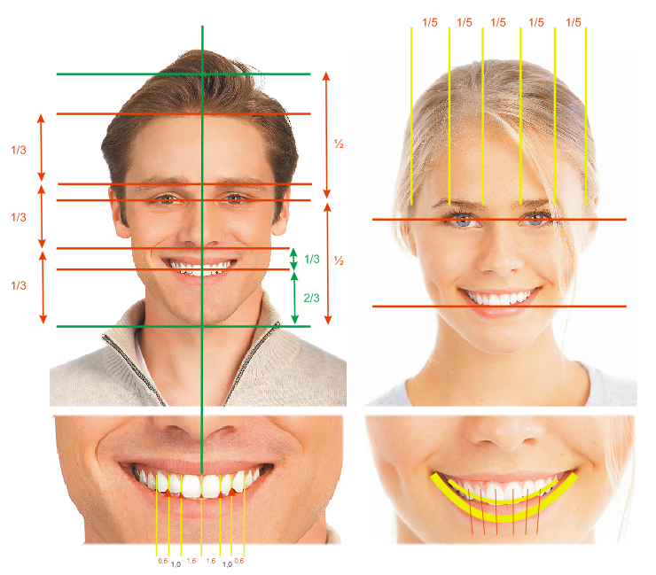 デジタルスマイルデザイン | 矯正歯科スマイルコンセプト