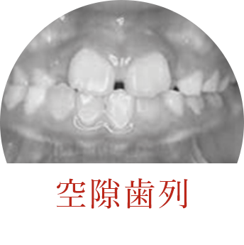 矯正歯科や歯列矯正の専門医院なら渋谷 横浜のスマイルコンセプト